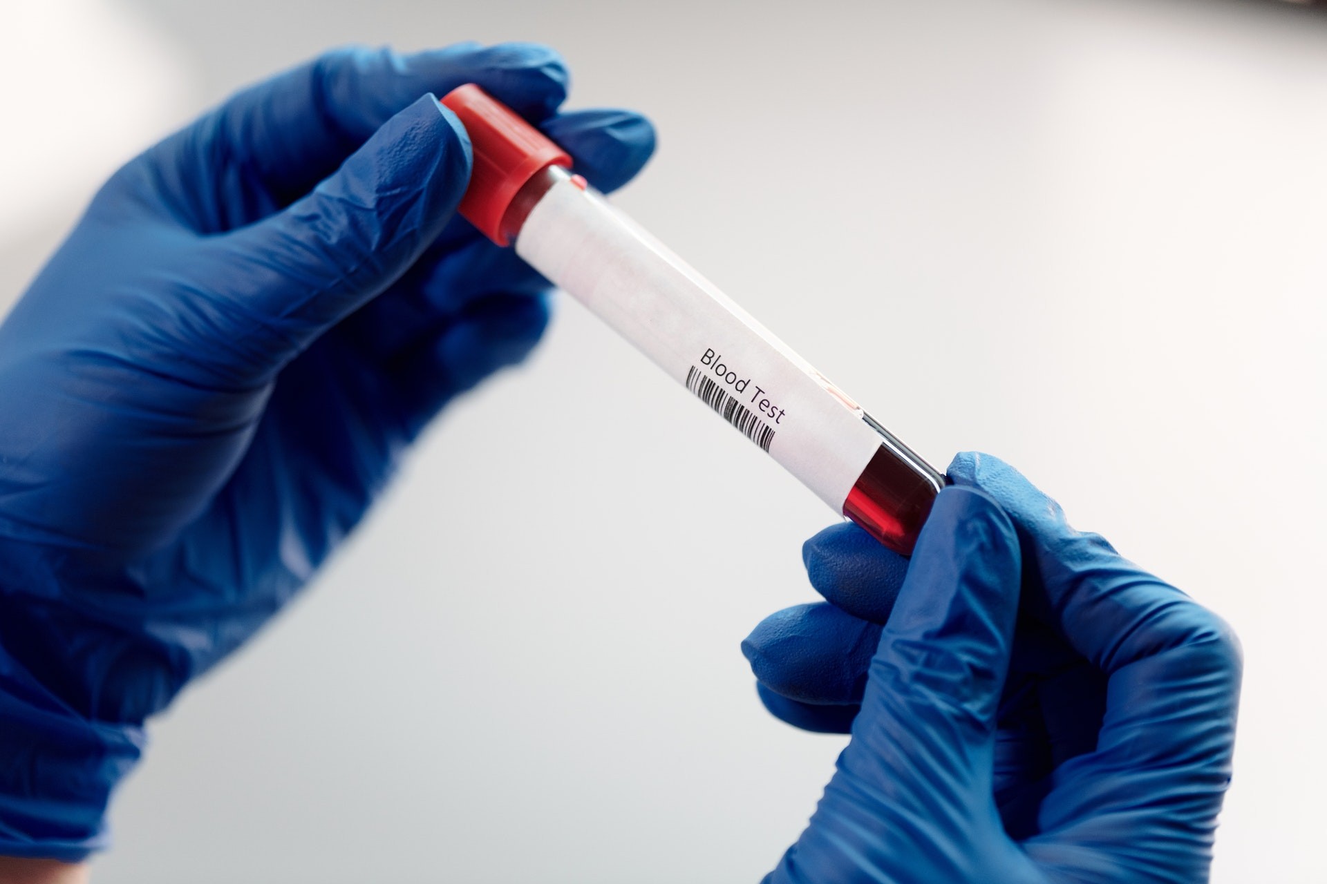 5 Ways PRP Injection Therapy Can Help You